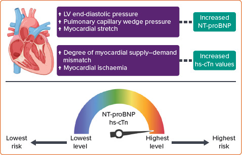 Biomarkers in Heart Failure with Preserved Ejection Fraction.