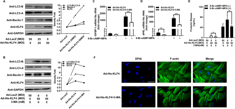 Decreased Krüppel-like factor 4 in adenomyosis impairs decidualization by repressing autophagy in human endometrial stromal cells.