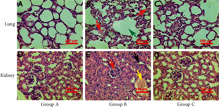 The Anti-Cytokine Storm Activity of Quercetin Zinc and Vitamin C Complex.