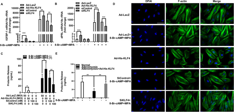 Decreased Krüppel-like factor 4 in adenomyosis impairs decidualization by repressing autophagy in human endometrial stromal cells.