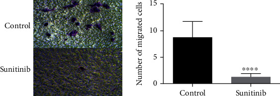 Sunitinib Reduced the Migration of Ectopic Endometrial Cells via p-VEGFR-PI3K-AKT-YBX1-Snail Signaling Pathway.