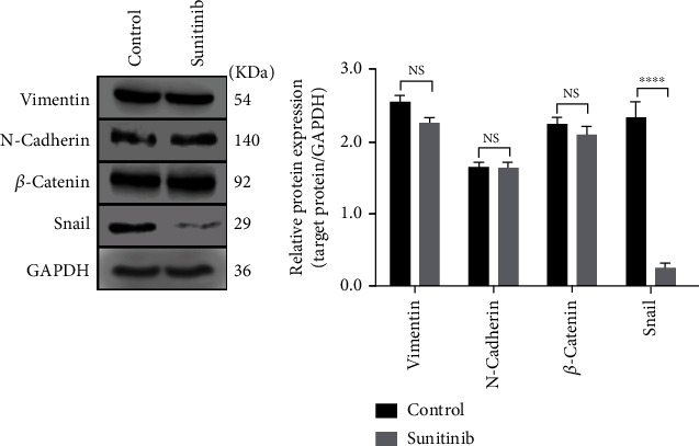 Sunitinib Reduced the Migration of Ectopic Endometrial Cells via p-VEGFR-PI3K-AKT-YBX1-Snail Signaling Pathway.