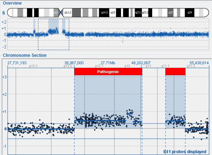 First case of two supernumerary markers derived from chromosome 5 and chromosome 8.