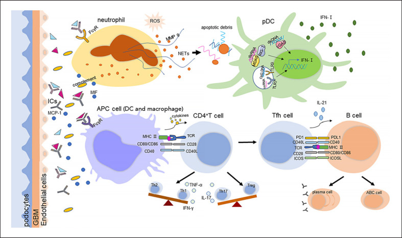 Association of Immune-Related Genetic and Epigenetic Alterations with Lupus Nephritis.