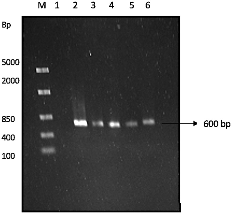 Isolation, screening, preliminary optimisation and characterisation of thermostable xylanase production under submerged fermentation by fungi in Durban, South Africa.