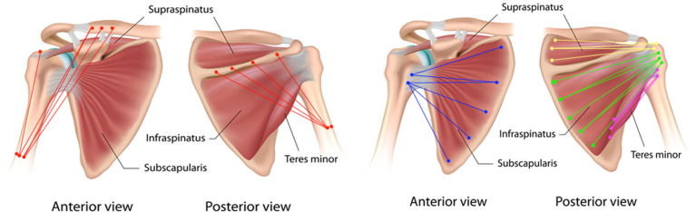 A Biomechanical Analysis of Shoulder Muscle Excursions During Abduction, After the Treatment of Massive Irreparable Rotator Cuff Tears Using Superior Capsular Reconstruction (SCR), Bursal Acromial Reconstruction (BAR), and SCR with BAR.