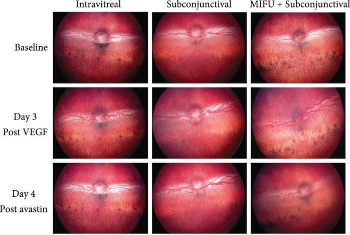 Development of Moderate Intensity Focused Ultrasound (MIFU) for Ocular Drug Delivery.