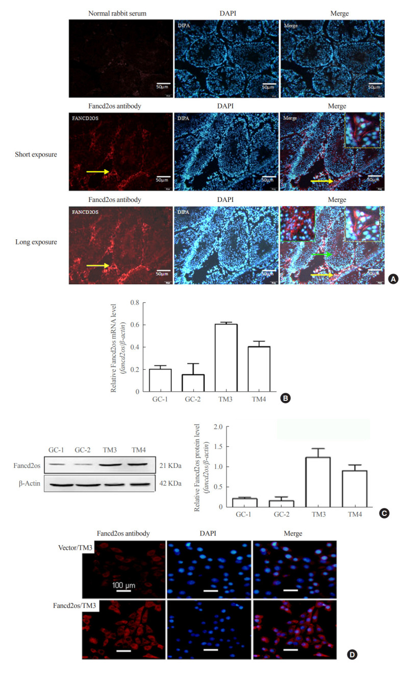 Fancd2os Reduces Testosterone Production by Inhibiting Steroidogenic Enzymes and Promoting Cellular Apoptosis in Murine Testicular Leydig Cells.
