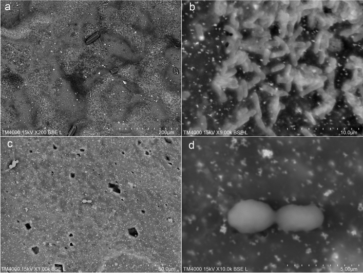 Analysis of purple urine bag syndrome by low vacuum scanning electron microscopy.