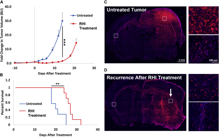 Spatiotemporal analysis of induced neural stem cell therapy to overcome advanced glioblastoma recurrence.