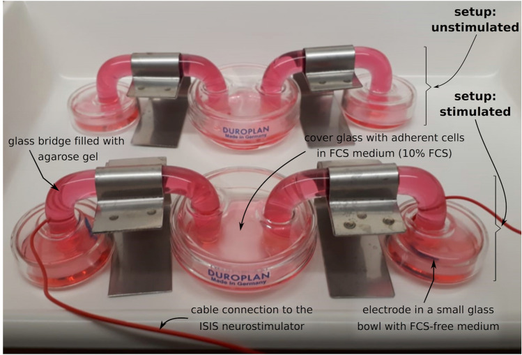 Influence of Simulated Deep Brain Stimulation on the Expression of Inflammatory Mediators by Human Central Nervous System Cells In Vitro.