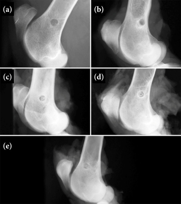 Evaluation of the degradation of two bioabsorbable interference screws: an in-vivo study in sheep.