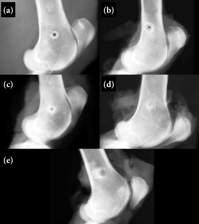 Evaluation of the degradation of two bioabsorbable interference screws: an in-vivo study in sheep.