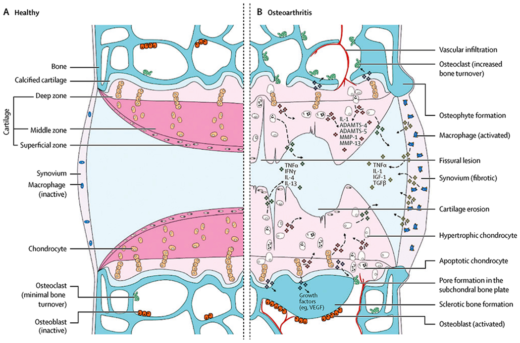 Regenerative Engineering Animal Models for Knee Osteoarthritis.