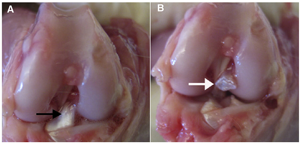 Regenerative Engineering Animal Models for Knee Osteoarthritis.