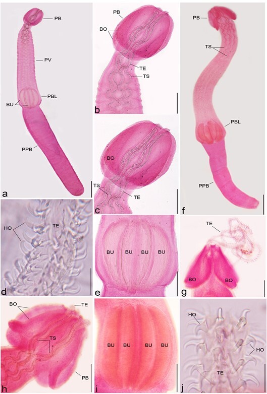 Larval cestodes infecting commercial fish of Alexandria coast along the Mediterranean Sea: morphology and phylogeny.