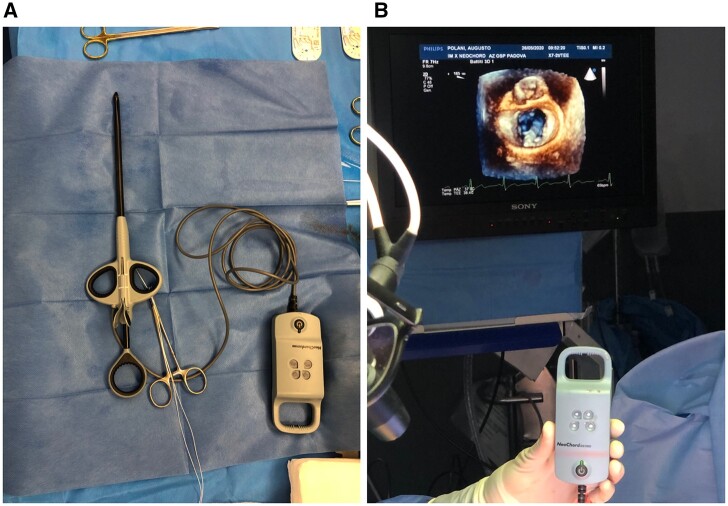 Transapical beating heart mitral valve repair versus conventional surgery: a propensity-matched study.