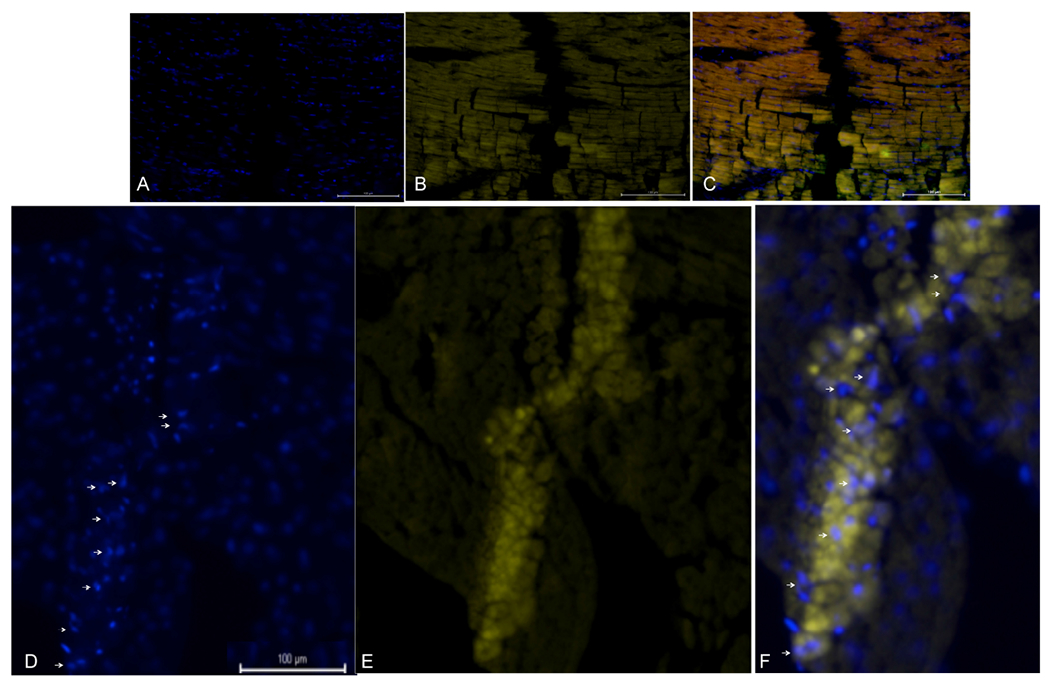 STEMIN and YAP5SA synthetic modified mRNAs regenerate and repair infarcted mouse hearts.