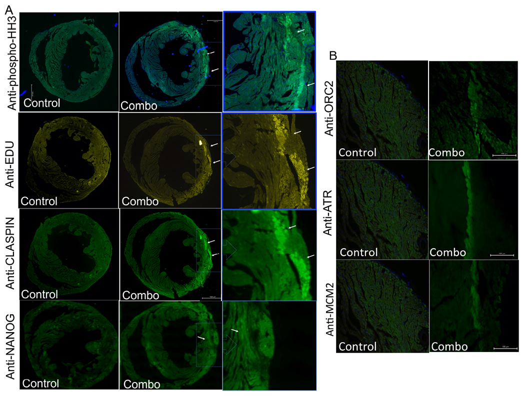 STEMIN and YAP5SA synthetic modified mRNAs regenerate and repair infarcted mouse hearts.