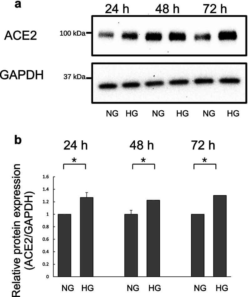 High D-glucose levels induce ACE2 expression via GLUT1 in human airway epithelial cell line Calu-3.