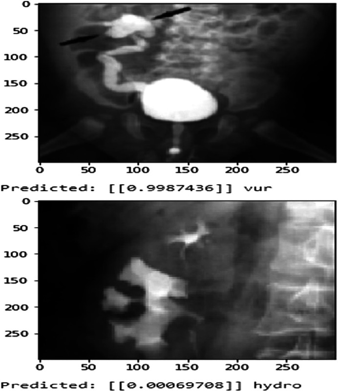 Deep Learning in Urological Images Using Convolutional Neural Networks: An Artificial Intelligence Study.