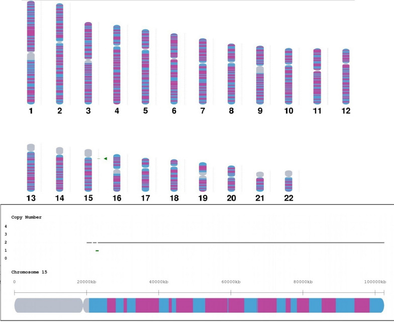 Prenatal diagnosis and genetic counseling of a paternally inherited chromosome 15q11.2 microdeletion in a Chinese family.