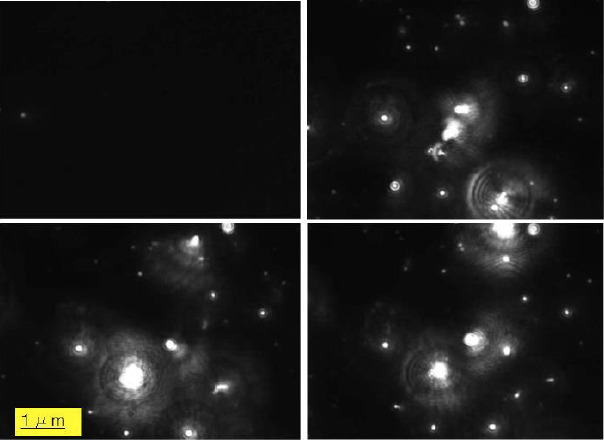 Hydrogen-rich bath with nano-sized bubbles improves antioxidant capacity based on oxygen radical absorbing and inflammation levels in human serum.