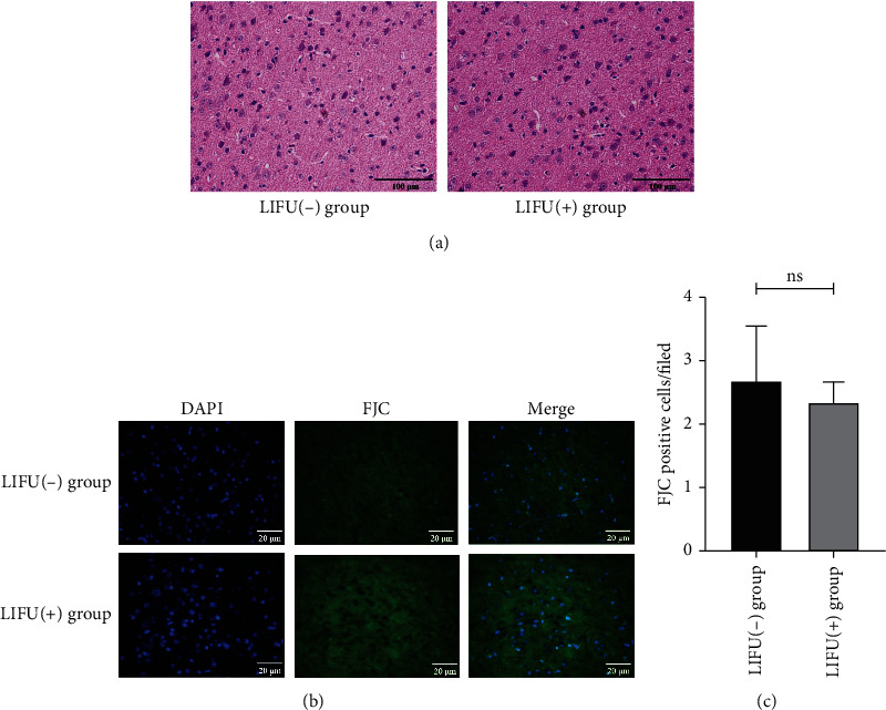 Low-Intensity Focused Ultrasound Alleviates Chronic Neuropathic Pain-Induced Allodynia by Inhibiting Neuroplasticity in the Anterior Cingulate Cortex.