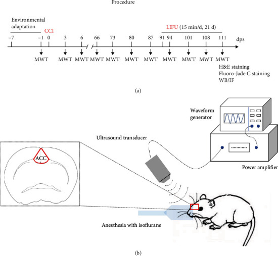 Low-Intensity Focused Ultrasound Alleviates Chronic Neuropathic Pain-Induced Allodynia by Inhibiting Neuroplasticity in the Anterior Cingulate Cortex.