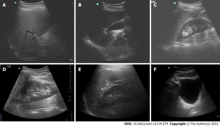 Robotic ultrasound: An initial feasibility study.