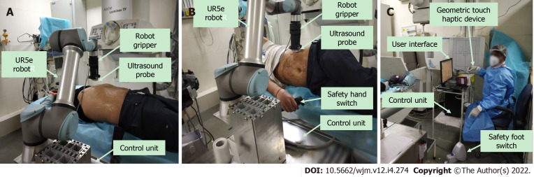 Robotic ultrasound: An initial feasibility study.