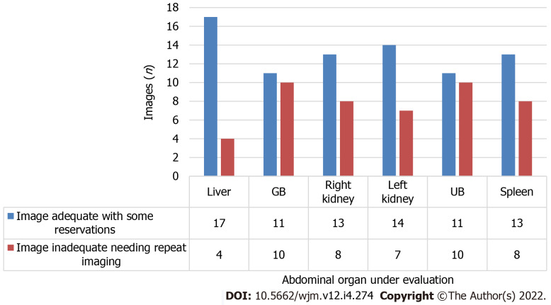 Robotic ultrasound: An initial feasibility study.