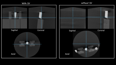 Evaluation of the dosimetry and centralization of scout-view function in CBCT.