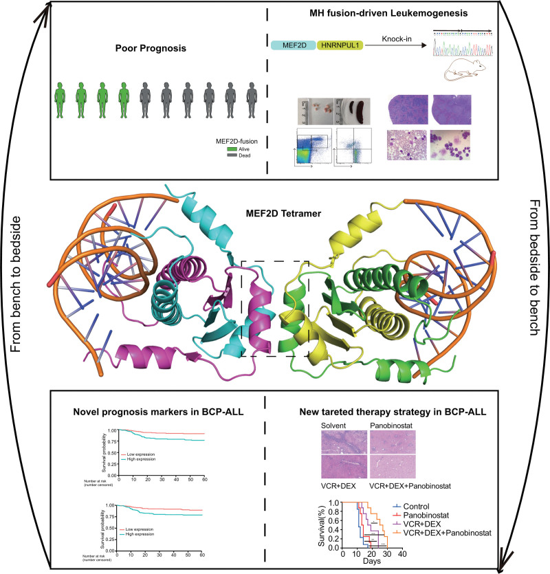 A typical bedside-to-bench investigation of leukemogenic driver MEF2D fusion reveals new targeted therapy in B-cell acute lymphoblastic leukemia.