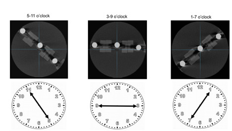 Evaluation of the dosimetry and centralization of scout-view function in CBCT.