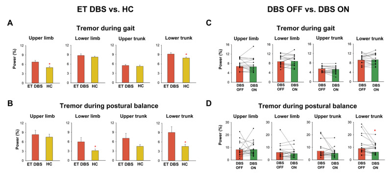 Suppression of Axial Tremor by Deep Brain Stimulation in Patients with Essential Tremor: Effects on Gait and Balance Measures.