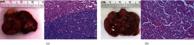 [<sup>18</sup>F]-(2S,4R)4-Fluoroglutamine PET Imaging of Glutamine Metabolism in Murine Models of Hepatocellular Carcinoma (HCC).