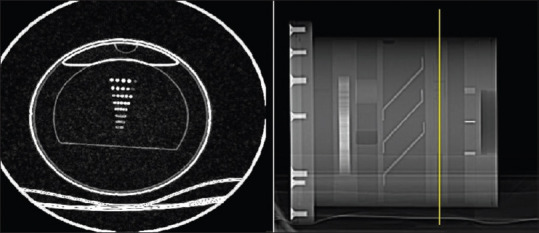 Pragmatic Approaches to Reducing Radiation Dose in Brain Computed Tomography Scan using Scan Parameter Modification.