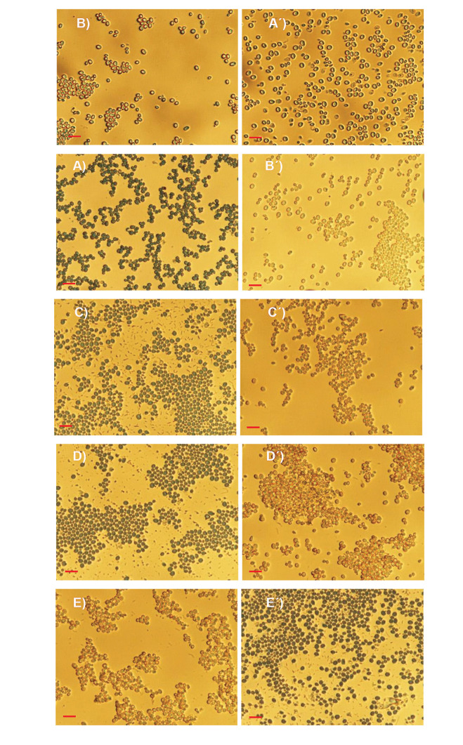 Acceleration of Yeast Autolysis by Addition of Fatty Acids, Ethanol and Alkaline Protease.