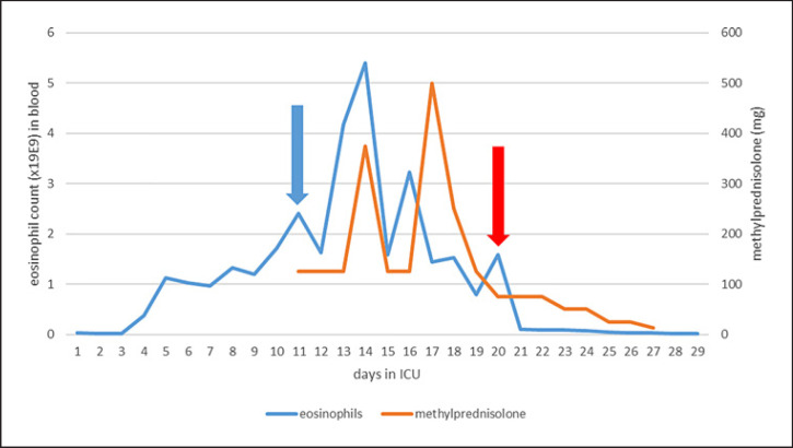 Severe Toxic Epidermal Necrolysis and Drug Reaction with Eosinophilia and Systemic Symptoms Overlap Syndrome Treated with Benralizumab: A Case Report.