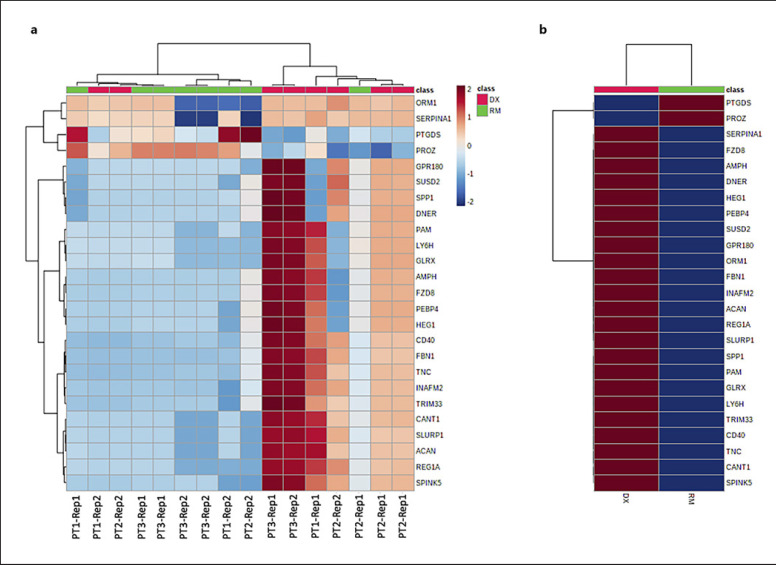 Quantitative Mass Spectrometry Normalization in Urine Biomarker Analysis in Nephrotic Syndrome.