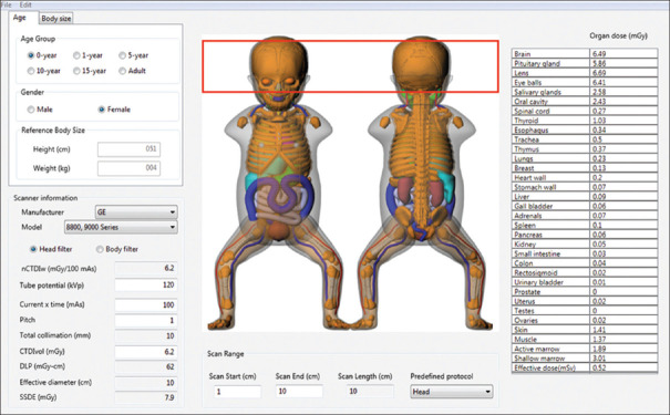 Pediatric effective dose assessment for routine computed tomography examinations in Tehran, Iran.