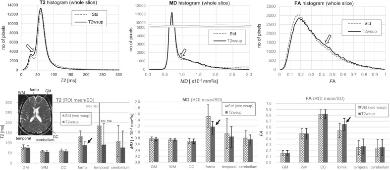 Diffusion MR Imaging with T2-based Water Suppression (T2wsup-dMRI).