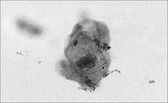 Diagnostic Accuracy and Agreement Between Inter- and Intra-Observers in the Absence of Clinical History for Liquid-Based Preparation of Gynecology Specimens.