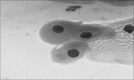 Diagnostic Accuracy and Agreement Between Inter- and Intra-Observers in the Absence of Clinical History for Liquid-Based Preparation of Gynecology Specimens.