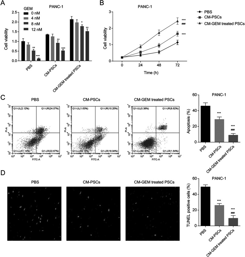 CXCL12 secreted by pancreatic stellate cells accelerates gemcitabine resistance of pancreatic cancer by enhancing glycolytic reprogramming.