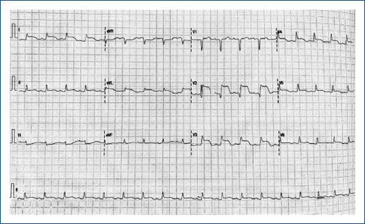 Cardiogenic shock as the initial manifestation of takotsubo syndrome.