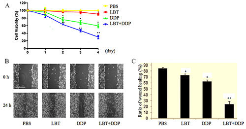 Lobetyolin suppressed lung cancer in a mouse model by inhibiting epithelial-mesenchymal transition.