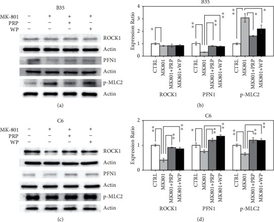 The Effects of Poria cocos on Rho Signaling-Induced Regulation of Mobility and F-Actin Aggregation in MK-801-Treated B35 and C6 Cells.