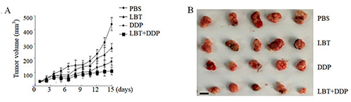 Lobetyolin suppressed lung cancer in a mouse model by inhibiting epithelial-mesenchymal transition.